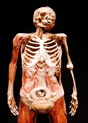 las vegas body museum 1